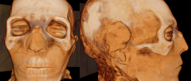 Scanning-the-Pharaohs-face-seti-I-1024x602