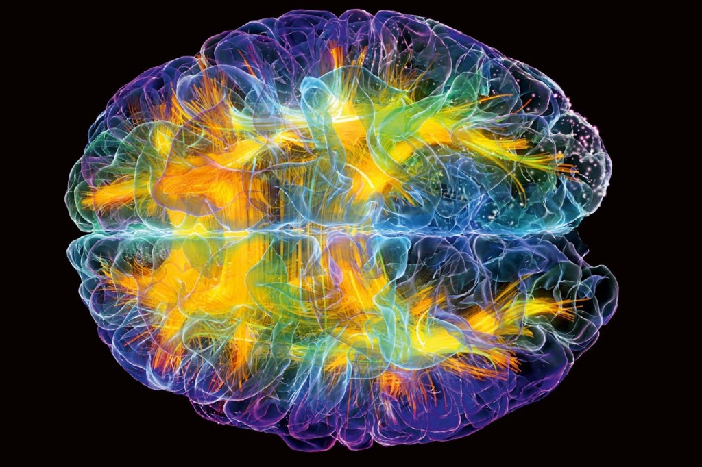 Brain_12