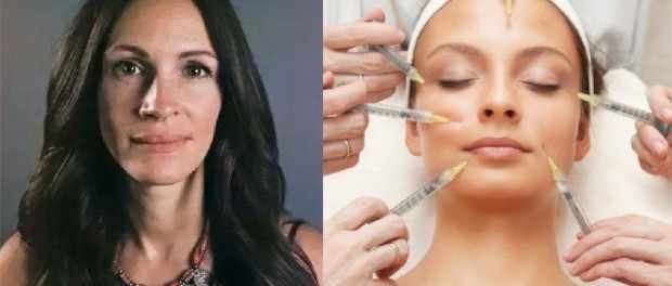 julia botox