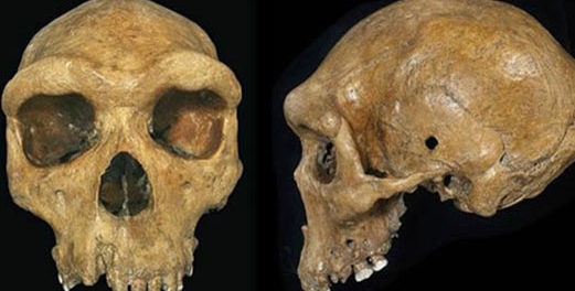 craniu1