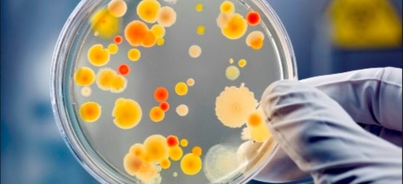 bacterii-1