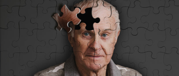 alzheimer
