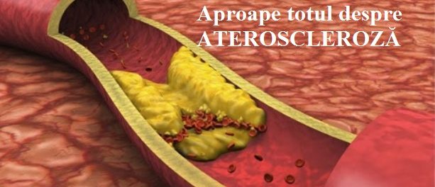 ATEROSCLEROZA