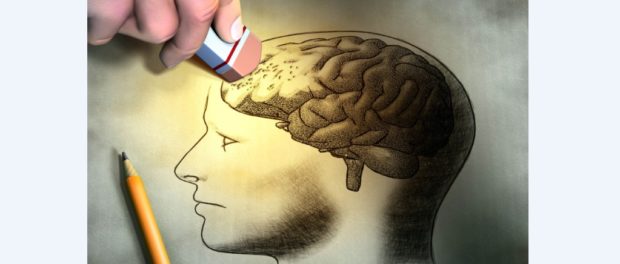 alzheimer 2