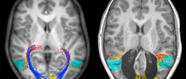 brain_scan