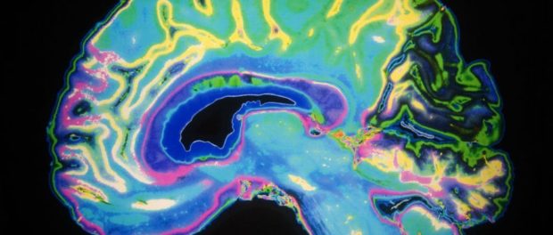 BrainScan_Thoughttrack_web_1024
