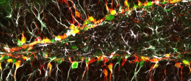 Colorful_Neurogenesis