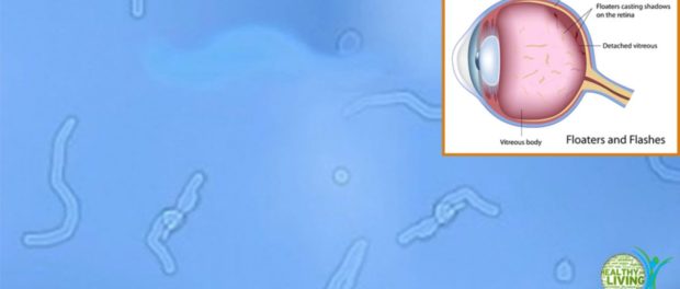 Scientists-Discover-a-New-Way-to-Reduce-Your-Eye-Floaters