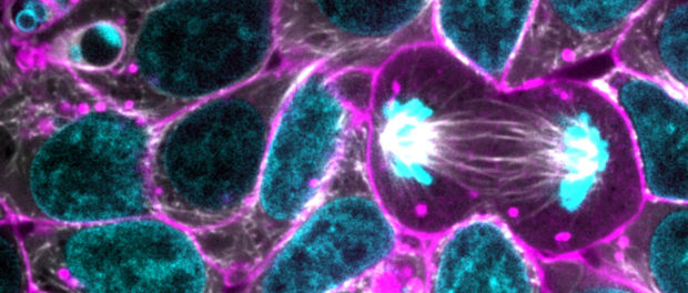 alpha-tubulin-1tif