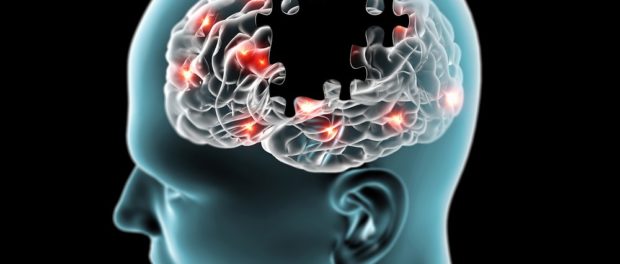 alzheimer 0