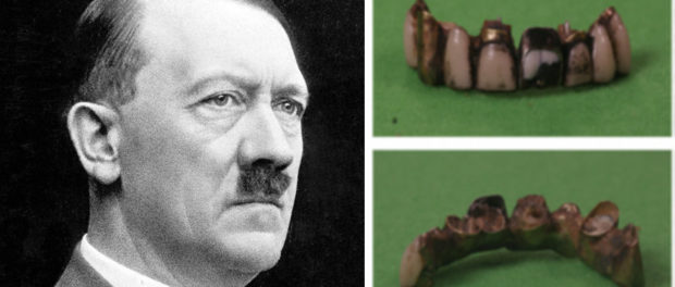 Adolf_teeth