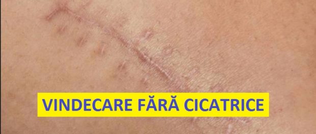 Vindecare fara cicatrice