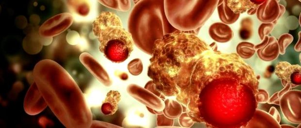 celule canceroase