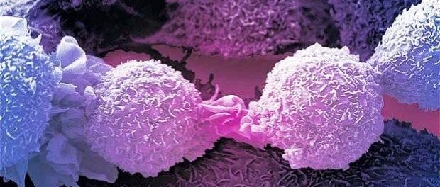 cancer celule noi