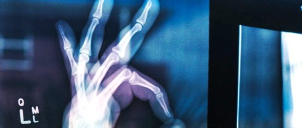 radiografie-pulmonara-xvision