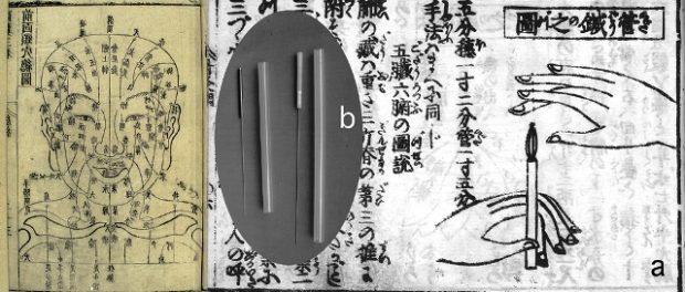 acupunctura faciala